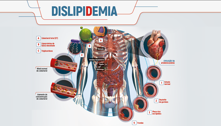 Dislipidemia Eurofarma 8214